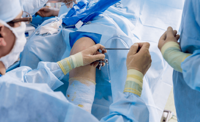 Cirugía artroscópica de rodilla en Zapopan: Innovación en Traumatología y ortopedia