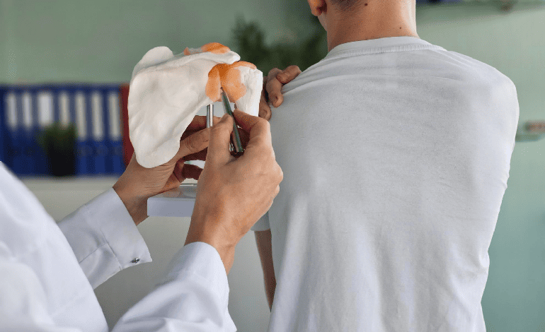 Cirugía de reemplazo articular de hombro en Zapopan: Solución avanzada en Traumatología y Ortopedia